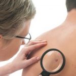 pag10_treatments.for_.Melanoma_A1_iSK_22750828_Small_460x261