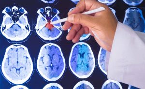 quanti uomini sono morti di cancro alla prostata nel 2020