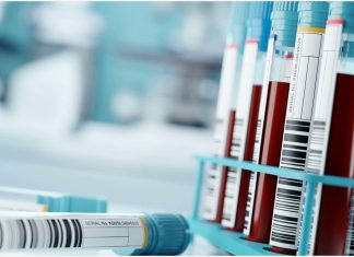 OLTRE 20 GIORNI DI RITARDO NELLE ANALISI DEL SANGUE NEL SUD DI GRAN CANARIA